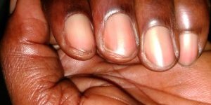 Entretien naturel des ongles 