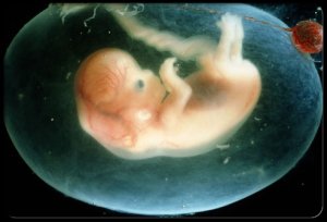 Recherche sur les embryons in vitro