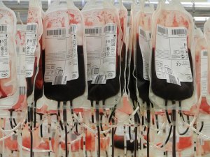Découverte de la transfusion sanguine